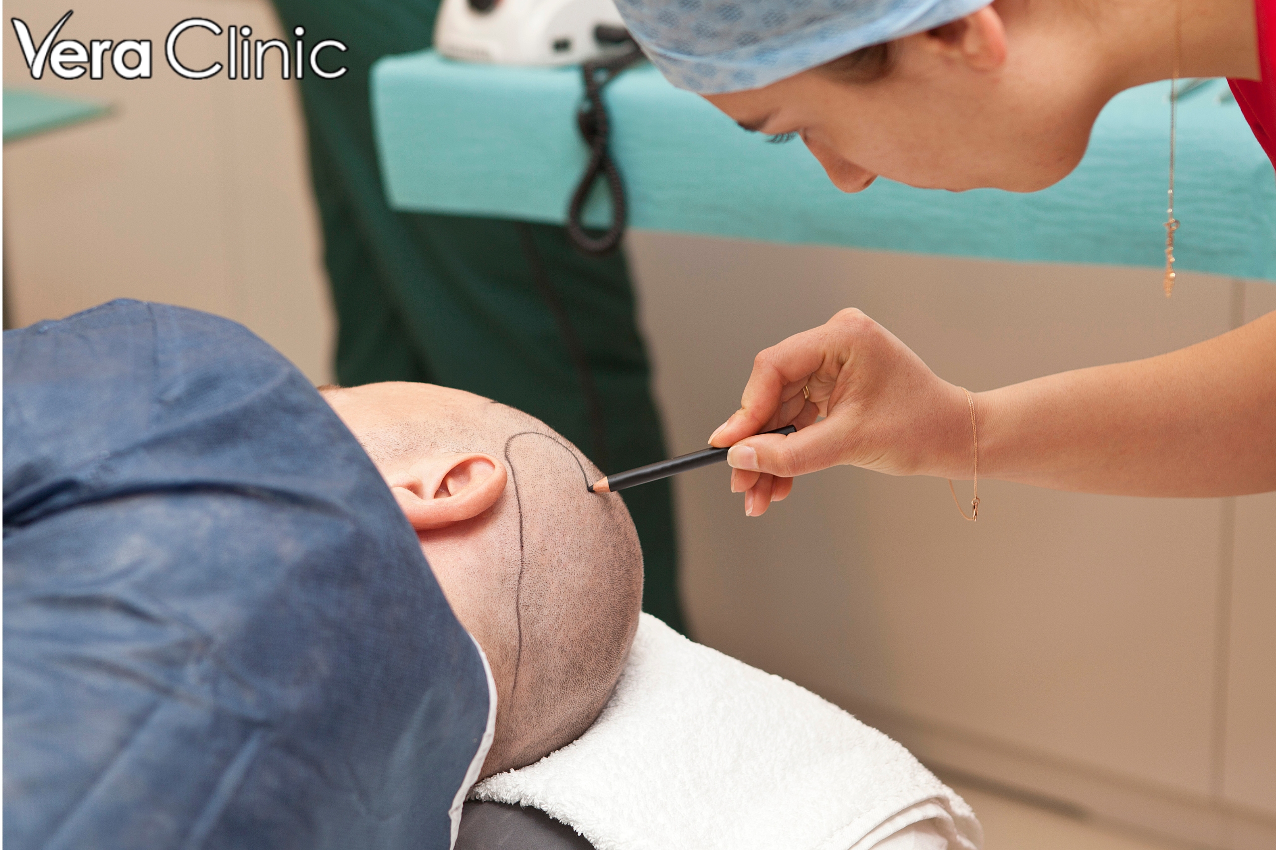 Celebrity Secrets: How Stars Get The Best Hair Transplants In Turkey